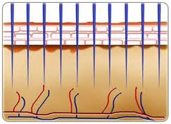 skin-needling